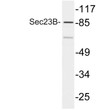 Western blot analysis of lysate from COLO205 cells, using Sec23B antibody. STJ95594