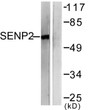 Western blot analysis of lysates from MDA-MB-435 cells, using SENP2 Antibody. The lane on the right is blocked with the synthesized peptide.
