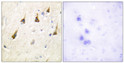 Immunohistochemistry analysis of paraffin-embedded human brain tissue, using SENP7 Antibody. The picture on the right is blocked with the synthesized peptide.