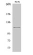 Western blot analysis of various cells using SENP7 Polyclonal Antibody cells nucleus extracted by Minute TM Cytoplasmic and Nuclear Fractionation kit (SC-003, Inventbiotech, MN, USA).