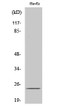 Western blot analysis of various cells using SENP8 Polyclonal Antibody