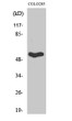 Western blot analysis of various cells using Septin 1 polyclonal antibody STJ95610