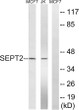Western blot analysis of lysates from Jurkat and MCF-7 cells, using SEPT2 Antibody. The lane on the right was blocked STJ95612