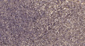 Immunohistochemical analysis of paraffin-embedded human uterus. 1, Antibody was diluted at 1:200 (4° overnight). 2, STJ95614