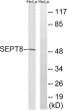 Western blot analysis of lysates from HeLa cells, using SEPT8 Antibody. The lane on the right was blocked with the STJ95617