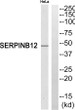 Western blot analysis of SERPINB12 Antibody. The lane on the right is blocked with the SERPINB12 peptide.