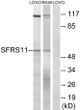 Western blot analysis of lysates from LOVO and RAW264.7 cells, using SFRS11 Antibody. The lane on the right is blocked with the synthesized peptide.