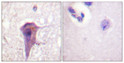 Immunohistochemical analysis of paraffin-embedded Human brain. Antibody was diluted at 1:100 (4°C overnight). High-pressure and temperature Tris-EDTA, pH8.0 was used for antigen retrieval. Negetive contrl (right) obtaned from antibody was pre-absorbed by immunogen peptide.