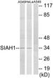 Western blot analysis of lysates from A549 and HeLa cells, using SIAH1 Antibody. The lane on the right is blocked with the synthesized peptide.