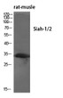 Western blot analysis of various cells using Siah-1/2 Polyclonal Antibody diluted at 1：500
