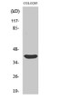 Western Blot analysis of various cells using Siah-2 Polyclonal Antibody STJ95662