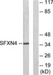 Western blot analysis of lysates from HUVEC cells, using SFXN4 Antibody. The lane on the right is blocked with the STJ95663