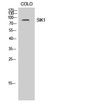 Western blot analysis of COLO cells using SIK1 Polyclonal Antibody