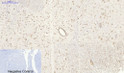 Immunohistochemical analysis of paraffin-embedded Rat-spinal-cord tissue. 1, SIRT1 Polyclonal Antibody was diluted at 1:200 (4°C, overnight). 2, Sodium citrate pH 6.0 was used for antibody retrieval (>98°C, 20min). 3, Secondary antibody was diluted at 1:200 (room tempeRature, 30min). Negative control was used by secondary antibody only.