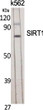 Western blot analysis of various cells using SIRT1 Polyclonal Antibody diluted at 1：2000