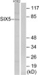 Western blot analysis of lysates from K562 cells, using SIX5 Antibody. The lane on the right is blocked with the synthesized peptide.