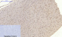 Immunohistochemical analysis of paraffin-embedded Mouse-brain tissue. 1, Smad2 Polyclonal Antibody was diluted at 1:200 (4°C, overnight). 2, Sodium citrate pH 6.0 was used for antibody retrieval (>98°C, 20min). 3, Secondary antibody was diluted at 1:200 (room tempeRature, 30min). Negative control was used by secondary antibody only.