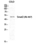 Western blot analysis of COLO cells using Smad2 Polyclonal Antibody diluted at 1：1000