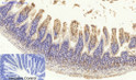 Immunohistochemical analysis of paraffin-embedded Mouse-colon tissue. 1, Smad2 Polyclonal Antibody was diluted at 1:200 (4°C, overnight). 2, Sodium citrate pH 6.0 was used for antibody retrieval (>98°C, 20min). 3, Secondary antibody was diluted at 1:200 (room tempeRature, 30min). Negative control was used by secondary antibody only.