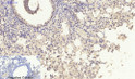 Immunohistochemical analysis of paraffin-embedded Mouse-lung tissue. 1, Smad2 Polyclonal Antibody was diluted at 1:200 (4°C, overnight). 2, Sodium citrate pH 6.0 was used for antibody retrieval (>98°C, 20min). 3, Secondary antibody was diluted at 1:200 (room tempeRature, 30min). Negative control was used by secondary antibody only.