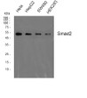 Western blot analysis of Smad2 Polyclonal Antibody, using Hela, HepG2, SW480, HEK293 cell, 4°C over night, secondary antibody (cat： (NA was diluted at 1:10000, 37°C 1hour.