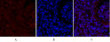 Immunofluorescence analysis of mouse-lung tissue. 1, Smad2 Polyclonal Antibody (red) was diluted at 1:200 (4°C, overnight). 2, Cy3 labled Secondary antibody was diluted at 1:300 (room temperature, 50min).3, Picture B: DAPI (blue) 10min. Picture A:Target. Picture B: DAPI. Picture C: merge of A+B
