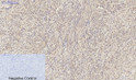 Immunohistochemical analysis of paraffin-embedded Human-uterus tissue. 1, Smad2 Polyclonal Antibody was diluted at 1:200 (4°C, overnight). 2, Sodium citrate pH 6.0 was used for antibody retrieval (>98°C, 20min). 3, Secondary antibody was diluted at 1:200 (room tempeRature, 30min). Negative control was used by secondary antibody only.
