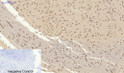 Immunohistochemical analysis of paraffin-embedded Rat-brain tissue. 1, Smad2 Polyclonal Antibody was diluted at 1:200 (4°C, overnight). 2, Sodium citrate pH 6.0 was used for antibody retrieval (>98°C, 20min). 3, Secondary antibody was diluted at 1:200 (room tempeRature, 30min). Negative control was used by secondary antibody only.