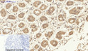 Immunohistochemical analysis of paraffin-embedded Human-stomach tissue. 1, Smad2 Polyclonal Antibody was diluted at 1:200 (4°C, overnight). 2, Sodium citrate pH 6.0 was used for antibody retrieval (>98°C, 20min). 3, Secondary antibody was diluted at 1:200 (room tempeRature, 30min). Negative control was used by secondary antibody only.