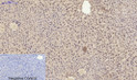 Immunohistochemical analysis of paraffin-embedded Mouse-liver tissue. 1, Smad2 Polyclonal Antibody was diluted at 1:200 (4°C, overnight). 2, Sodium citrate pH 6.0 was used for antibody retrieval (>98°C, 20min). 3, Secondary antibody was diluted at 1:200 (room tempeRature, 30min). Negative control was used by secondary antibody only.