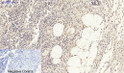 Immunohistochemical analysis of paraffin-embedded Human-Appendix tissue. 1, Smad2 Polyclonal Antibody was diluted at 1:200 (4°C, overnight). 2, Sodium citrate pH 6.0 was used for antibody retrieval (>98°C, 20min). 3, Secondary antibody was diluted at 1:200 (room tempeRature, 30min). Negative control was used by secondary antibody only.