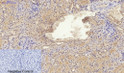 Immunohistochemical analysis of paraffin-embedded Mouse-kidney tissue. 1, Smad2 Polyclonal Antibody was diluted at 1:200 (4°C, overnight). 2, Sodium citrate pH 6.0 was used for antibody retrieval (>98°C, 20min). 3, Secondary antibody was diluted at 1:200 (room tempeRature, 30min). Negative control was used by secondary antibody only.