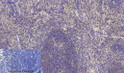 Immunohistochemical analysis of paraffin-embedded Mouse-spleen tissue. 1, Smad2 Polyclonal Antibody was diluted at 1:200 (4°C, overnight). 2, Sodium citrate pH 6.0 was used for antibody retrieval (>98°C, 20min). 3, Secondary antibody was diluted at 1:200 (room tempeRature, 30min). Negative control was used by secondary antibody only.