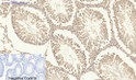 Immunohistochemical analysis of paraffin-embedded Rat-testis tissue. 1, Smad2 Polyclonal Antibody was diluted at 1:200 (4°C, overnight). 2, Sodium citrate pH 6.0 was used for antibody retrieval (>98°C, 20min). 3, Secondary antibody was diluted at 1:200 (room tempeRature, 30min). Negative control was used by secondary antibody only.