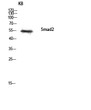 Western blot analysis of KB lysis using Smad2 antibody. Antibody was diluted at 1:1000
