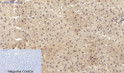 Immunohistochemical analysis of paraffin-embedded Rat-liver tissue. 1, Smad2 Polyclonal Antibody was diluted at 1:200 (4°C, overnight). 2, Sodium citrate pH 6.0 was used for antibody retrieval (>98°C, 20min). 3, Secondary antibody was diluted at 1:200 (room tempeRature, 30min). Negative control was used by secondary antibody only.