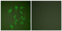 Immunofluorescence analysis of HepG2 cells, using Smad2 Antibody. The picture on the right is blocked with the synthesized peptide.