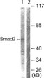 Western blot analysis of lysates from HepG2 cells, using Smad2 Antibody. The lane on the right is blocked with the synthesized peptide.