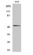 Western blot analysis of HT29 cells using Smad3 Polyclonal Antibody diluted at 1：500