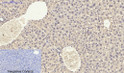 Immunohistochemical analysis of paraffin-embedded Mouse-liver tissue. 1, Smad3 Polyclonal Antibody was diluted at 1:200 (4°C, overnight). 2, Sodium citrate pH 6.0 was used for antibody retrieval (>98°C, 20min). 3, Secondary antibody was diluted at 1:200 (room tempeRature, 30min). Negative control was used by secondary antibody only.