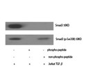 Western blot analysis of various cells using Smad3 Polyclonal Antibody diluted at 1：500