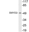 Western blot analysis of lysate from HT29 cells, using SMYD2 antibody. STJ95715