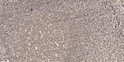 Immunohistochemical analysis of paraffin-embedded human tonsil. 1, Tris-EDTA, pH 9.0 was used for antigen retrieval. 2, STJ95734