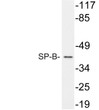 Western blot analysis of lysate from A549 cells, using SP-B antibody. STJ95745