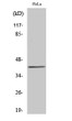 Western Blot analysis of various cells using SR-1E Polyclonal Antibody STJ95759
