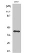 Western Blot analysis of various cells using SR-1F Polyclonal Antibody diluted at 1:1000 STJ95760