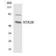 Western blot analysis of the lysates from COLO205 cells using HTR2B antibody.