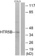 Western blot analysis of lysates from COLO cells, using HTR5B Antibody. The lane on the right is blocked with the synthesized peptide. Western blot analysis of lysates from COLO cells, using HTR5B Antibody. The lane on the right is blocked with the synthesized peptide.