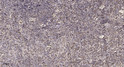 Immunohistochemical analysis of paraffin-embedded human spleen. 1, Tris-EDTA, pH 9.0 was used for antigen retrieval. 2, STJ95783