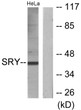 Western blot analysis of lysates from HeLa cells, using SRY Antibody. The lane on the right was blocked with the STJ95789